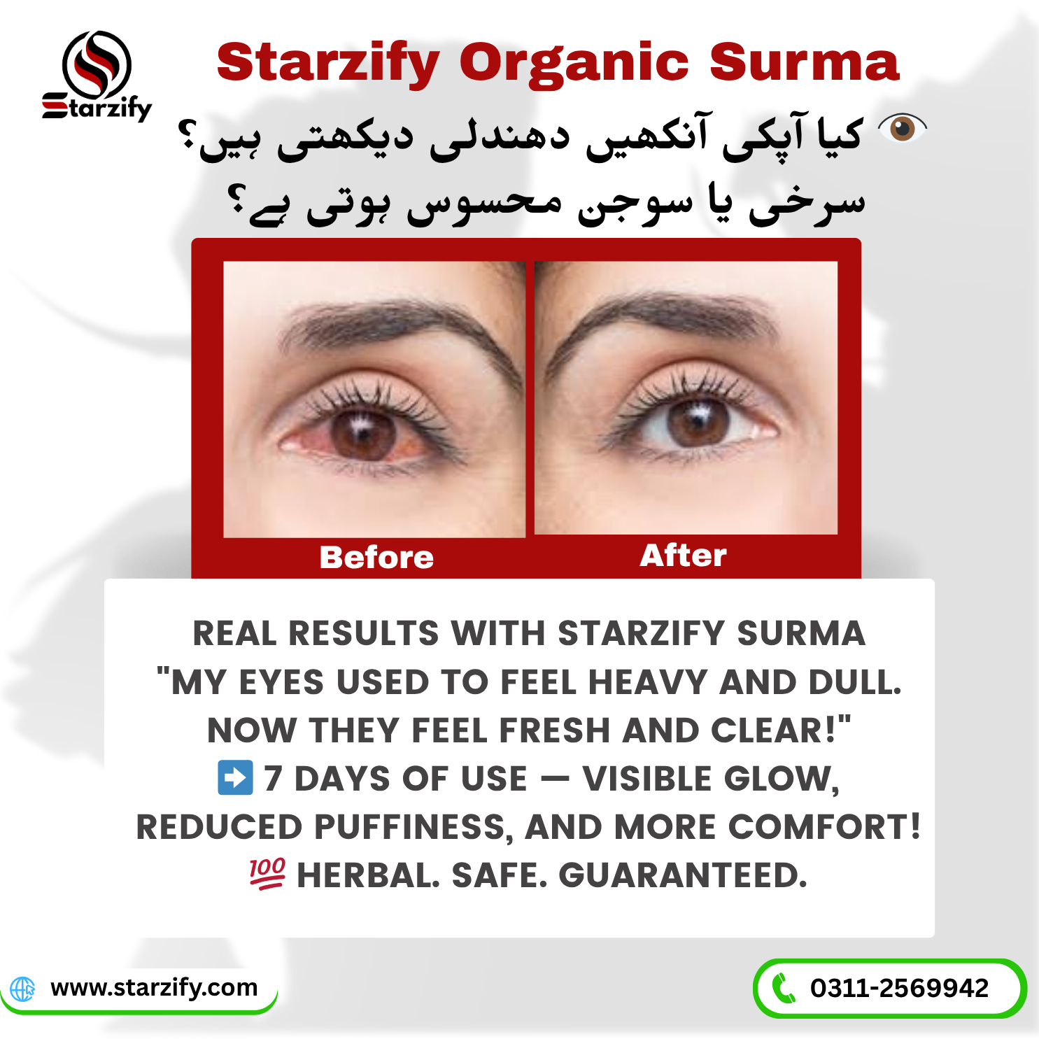 Starzify Surma - Image 7
